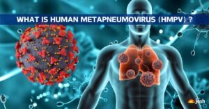What-is-Human-Metapneumovirus-(HMPV) HMPV ( human metapneumovirus)